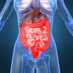 Boala crohn (colita granulomatoasa transmurala, colita segmentala)